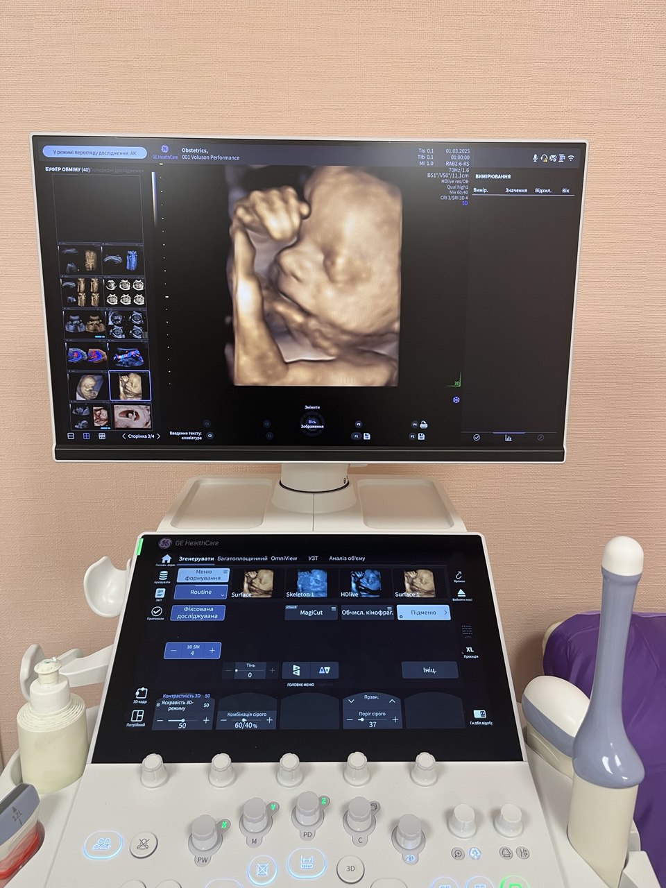 Ультразвукова діагностика